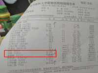 正常尿酸是多少(尿酸多少算正常？)