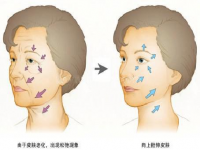 去皱快速方法(衣服如何快速去皱的方法)