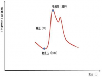 底压高什么原因(低压高是怎么回事)