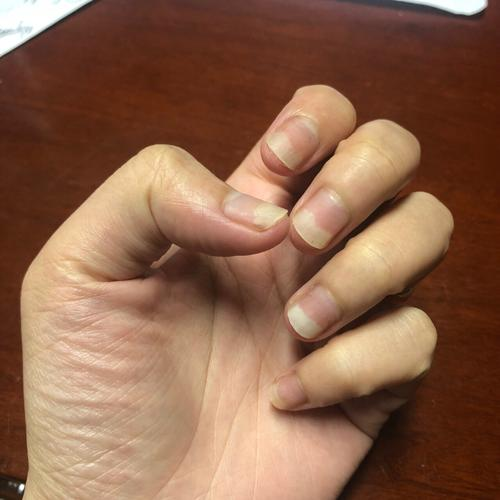 美甲怎么卸掉