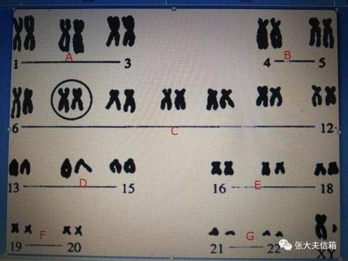 人有几对染色体