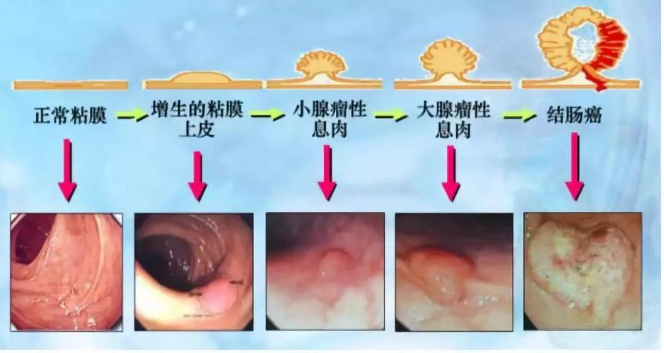 肠镜属于哪个科